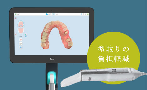 型取りの負担軽減